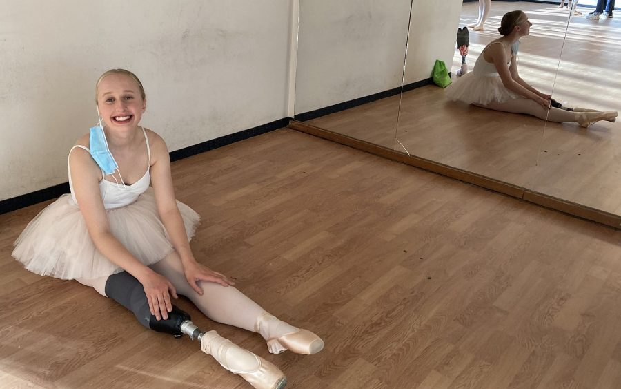 Amputee ballet dancer appeals for 'en pointe' prosthetic foot